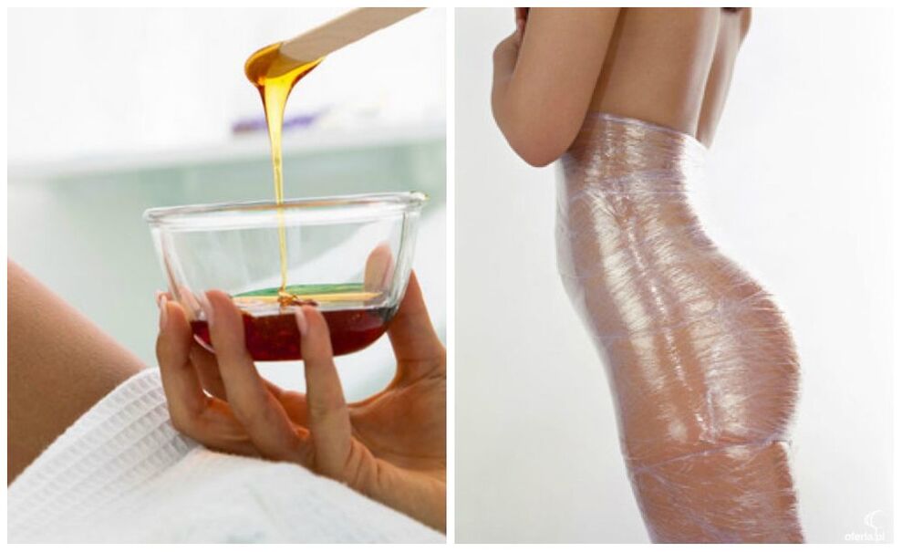 обвивки за тяло за отслабване